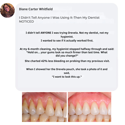 Orevela® Wild Oregano & Black Seed Oil - ELIMINATES GUM DISEASE