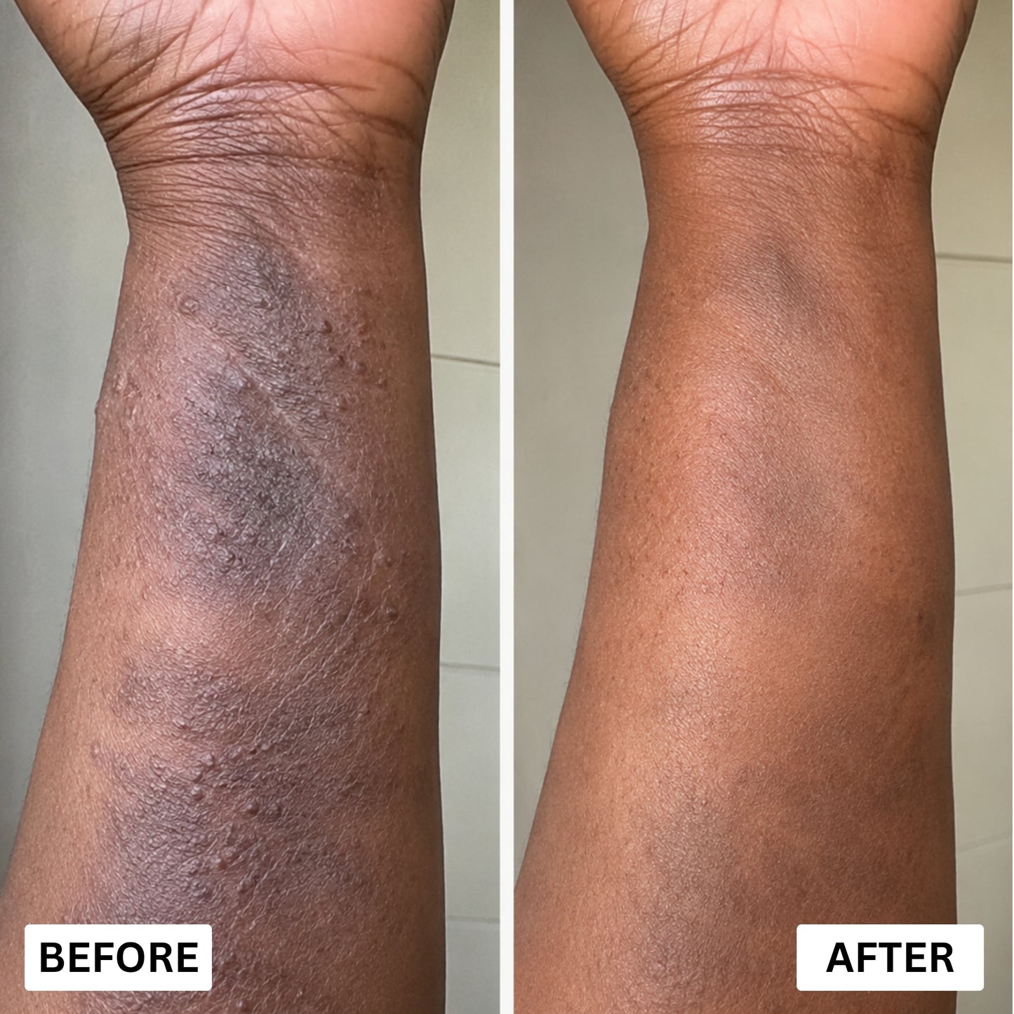 Orevela® Wild Oregano & Black Seed Oil - Calms Eczema From The Inside, Not The Surface