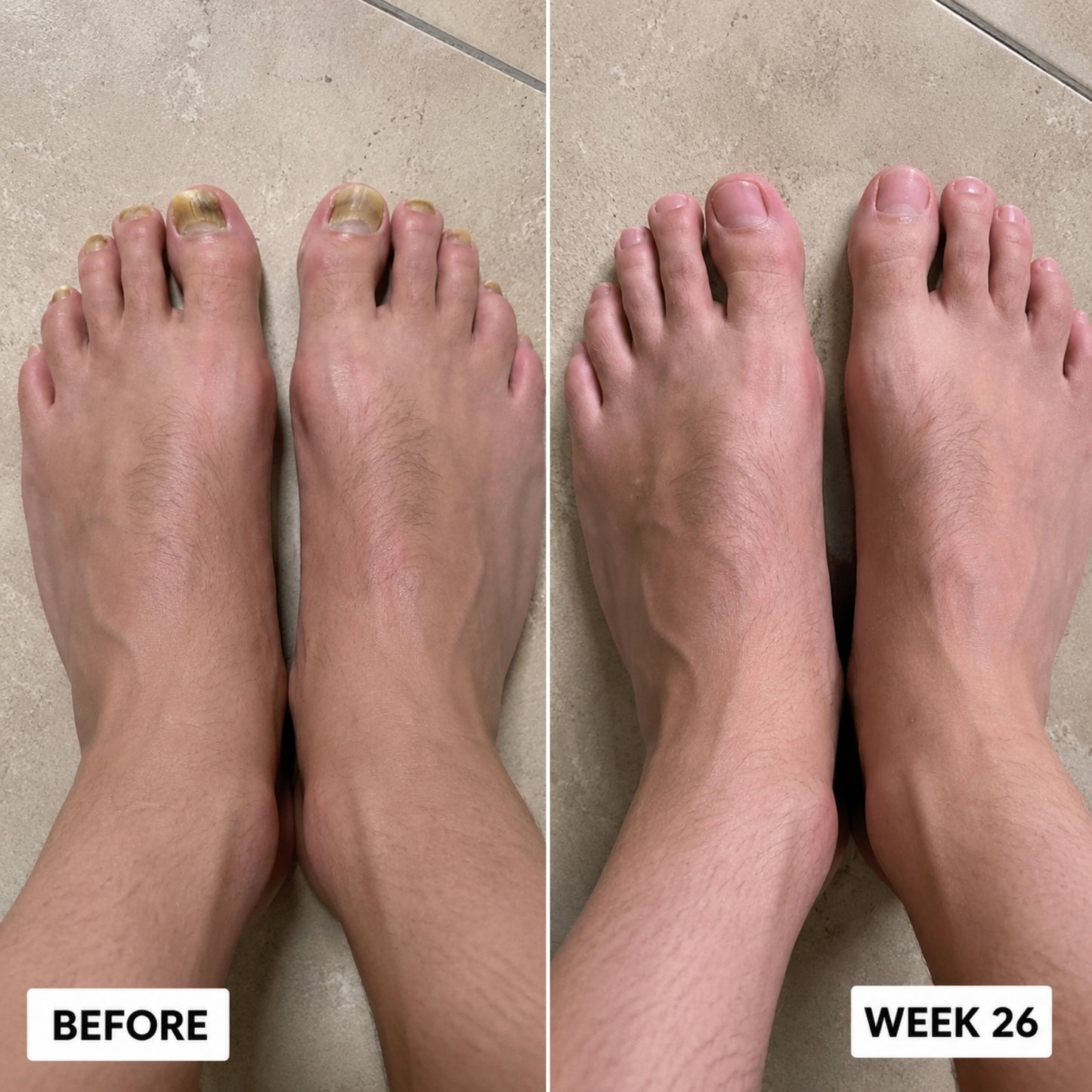 Orevela® Wild Oregano & Black Seed Oil - Calms Eczema From The Inside, Not The Surface