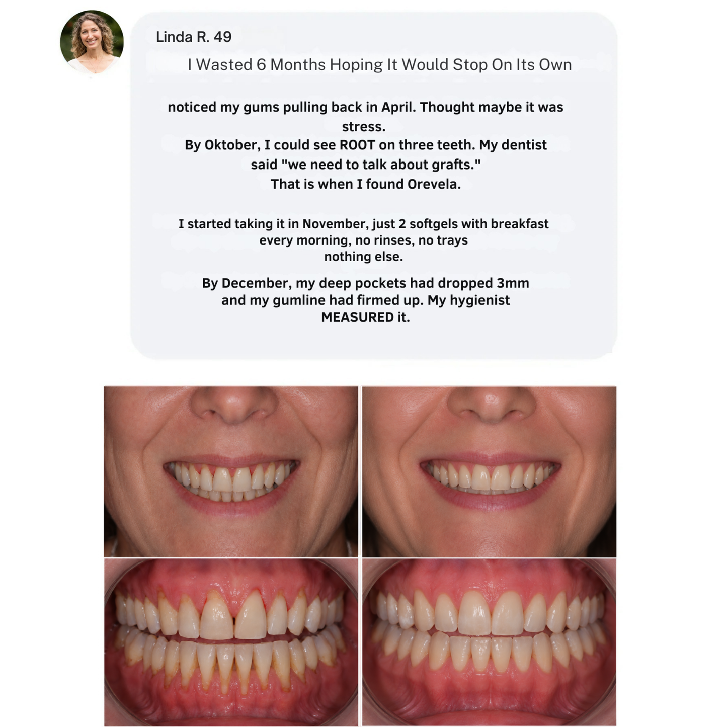 Orevela® Wild Oregano & Black Seed Oil - ELIMINATES GUM DISEASE