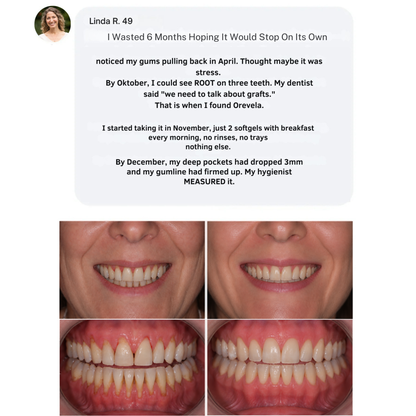 Orevela® Wild Oregano & Black Seed Oil - ELIMINATES GUM DISEASE